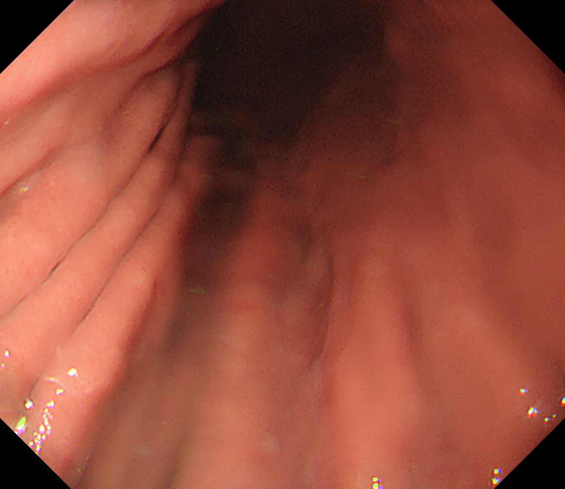 �̉������^